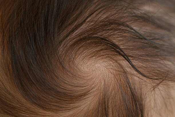 Common Causes Behind Thinning Hair in Women and Men