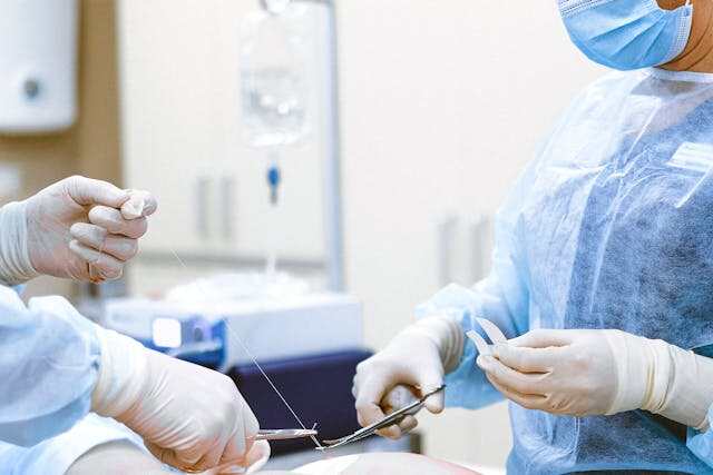things to know before pastic surgery